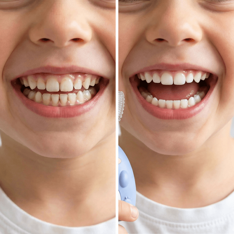 DinoBrush™ Cepillo de Dientes para Niños